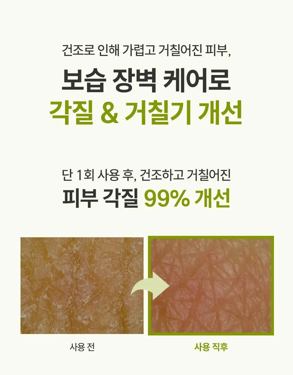[2025 어워즈] 제로이드 인텐시브 크림 80ml 상세페이지 25